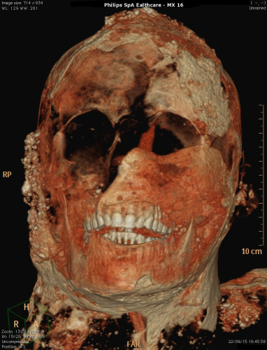 tac calchi pompei (1)