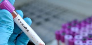 Coronavirus, nuovo caso positivo in Campania: si attende dell’Iss