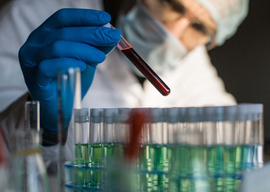 Researcher looking on blood sample in test tube.