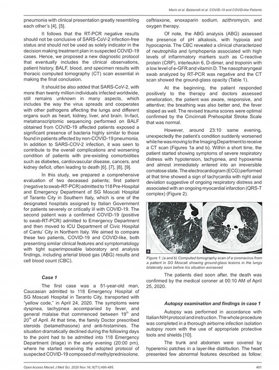 Covid e covid-like Open Access Macedonian Journal of Medical Sciences