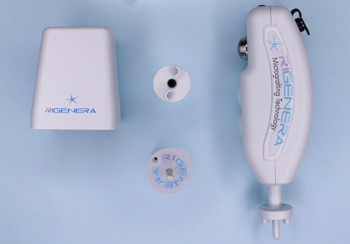 rigenera hbw 1 rigenera hbw 1