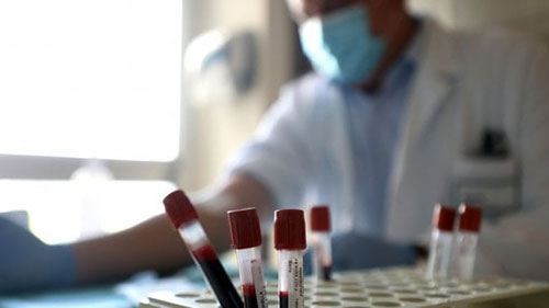 Covid, in Campania il virus rialza la testa: casi in aumento del 12%. Molto basse le percentuali dei vaccinati Covid, in Campania il virus rialza la testa: casi in aumento del 12%. Molto basse le percentuali dei vaccinati