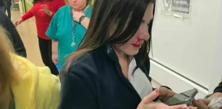 Castellammare, pugni a un'infermiera del Pronto soccorso: spaccati denti e naso