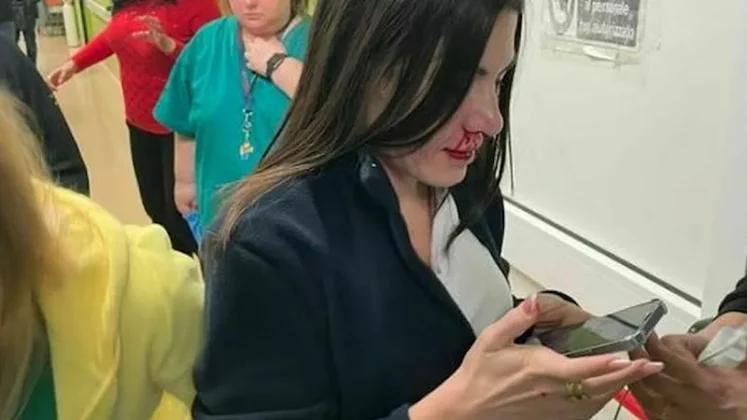 Castellammare, pugni a un'infermiera del Pronto soccorso: spaccati denti e naso