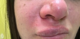Castellammare, infermiere brutalmente picchiate da un uomo al pronto soccorso. Aggressore in fuga, indagini in corso. L'Asl: "Stanchi delle violenze"