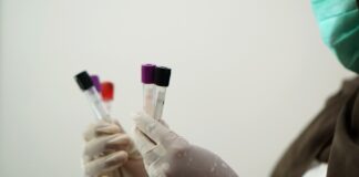 Piano di Sorrento, caso di legionella in una scuola: attivate tutte le procedure. Il sindaco: "Nessun motivo di preoccupazione"