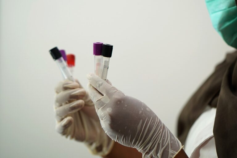 Piano di Sorrento, caso di legionella in una scuola Piano di Sorrento, caso di legionella in una scuola