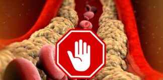 Allarme colesterolo, cosa non bisogna assolutamente mangiare durante il giorno: cosa si rischia