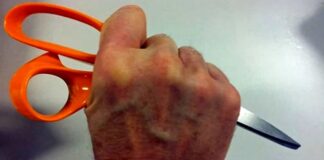 Giugliano, accende barbecue in giardino di un parco privato e aggredisce carabinieri. Arrestato 27enne