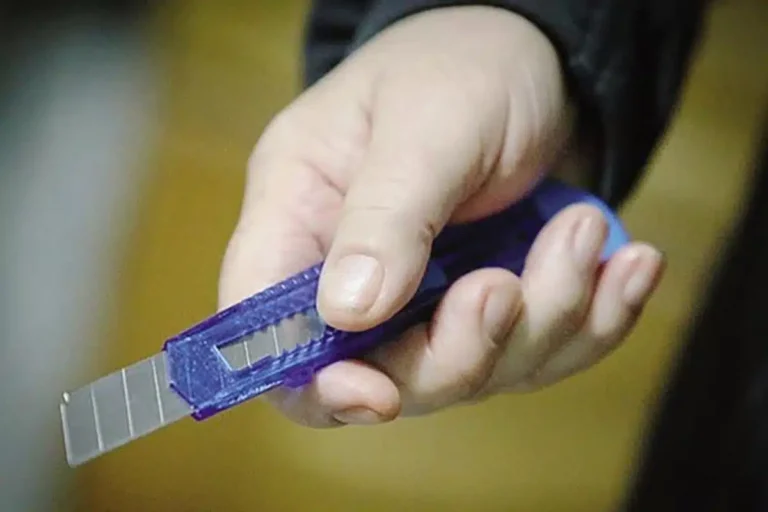 Napoli, ferito 64enne srilankese alle gambe con un taglierino