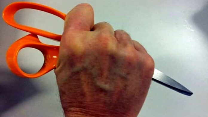 Napoli, tunisino 22enne accoltellato alla schiena per uno spinello. Arrestato 42enne