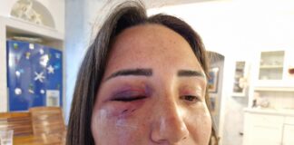 Pozzuoli: coinvolti nell’aggressione dell’ex compagna di Amirante, due persone ai domiciliari