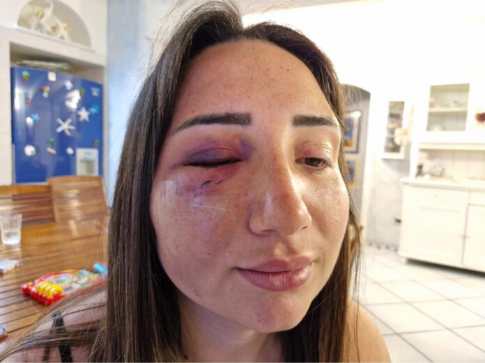Pozzuoli: coinvolti nell’aggressione dell’ex compagna di Amirante, due persone ai domiciliari