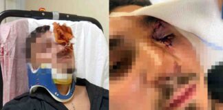 Portici, rissa al Granatello: sedicenne pestato e ricoverato