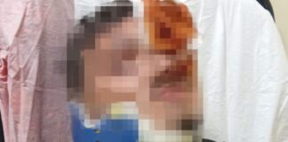 Ercolano, 16enne operato al volto dopo un'aggressione al Granatello: "È stato un intervento importante"