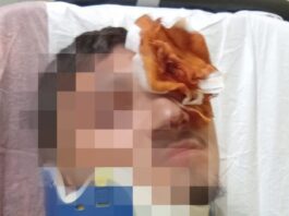 Portici, sedicenne pestato dal branco per un saluto alla ex di un coetaneo: ricoverato con gravi ferite