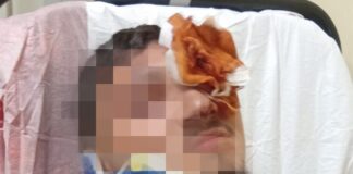 Portici, sedicenne pestato dal branco per un saluto alla ex di un coetaneo: ricoverato con gravi ferite