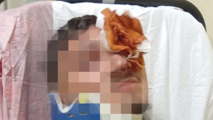 Portici, sedicenne pestato dal branco per un saluto alla ex di un coetaneo: ricoverato con gravi ferite