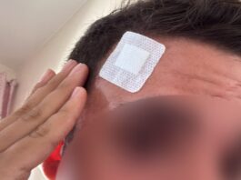 Ottaviano, ragazzo disabile aggredito: intervengono i servizi sociali