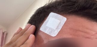 Ottaviano, ragazzo disabile aggredito: intervengono i servizi sociali