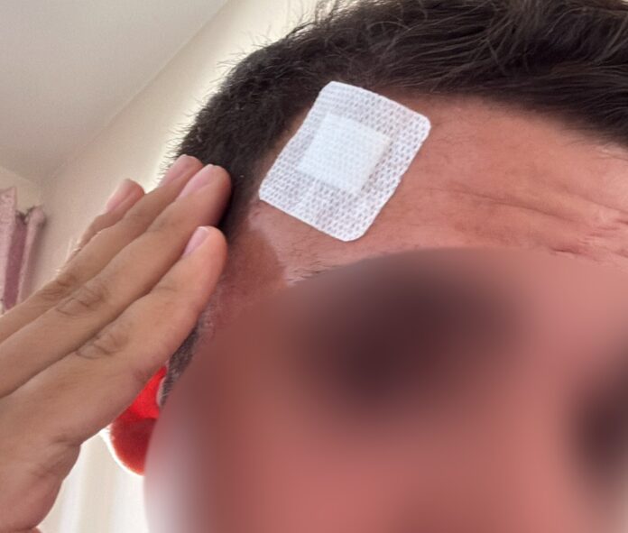 Ottaviano, ragazzo disabile aggredito: intervengono i servizi sociali