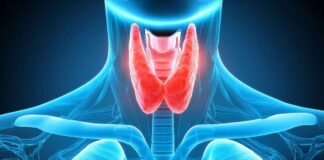 TIROIDE DA NAPOLI L’ALLARME DEGLI ESPERTI NE SOFFRE IL 10 PER CENTO DEGLI ITALIANI