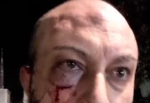 Poggiomarino, vigilante aggredito mentre difende il nuovo treno Eav Poggiomarino, vigilante aggredito mentre difende il nuovo treno Eav