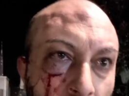 Poggiomarino, vigilante aggredito mentre difende il nuovo treno Eav